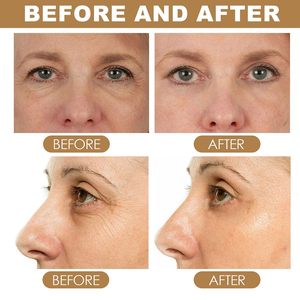 AiXin Private Label crema per gli occhi con retinolo e collagene occhiaie occhiaie gonfie e strette al collagene retinolo bastone per gli occhi - Product Image 6