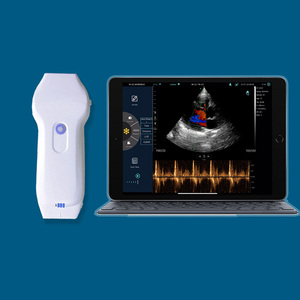 Ultrasuara portabel nirkabel Cd2 bersertifikat CE untuk klinik jantung (Ultrasonido Inalambrico) - Product Image 2
