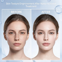Appareil de soin du visage à microcristaux de diamant, nettoyage en profondeur, exfoliation, hydratation, instrument de beauté pour les soins de la peau à domicile
