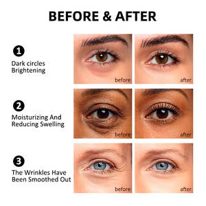 Bandas de Cera <span class=keywords><strong>para</strong></span> <span class=keywords><strong>Cejas</strong></span> LUCKY BERRY, Mascarilla de <span class=keywords><strong>Gel</strong></span> Dorada <span class=keywords><strong>para</strong></span> Ojos con Aloe Vera <span class=keywords><strong>para</strong></span> Mujeres - Antiarrugas y Ojeras, Directo de Fábrica - Product Image 6