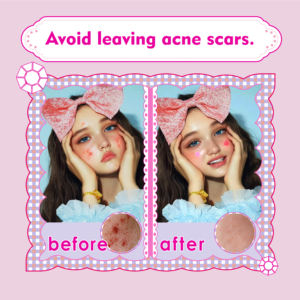 Stiker berkilau tahan air dengan Jerawat, stiker berlian modis, tambalan kristal untuk jerawat - Product Image 4