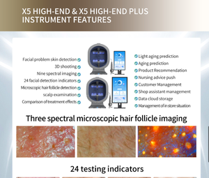 Offre Spéciale : Analyseur de Peau 3D IA Grand Espace d'Observation, Texture Métallique, Révèle les Pores, les Pigments et les Rides, Localise Précisément les Problèmes Cutanés - Product Image 5