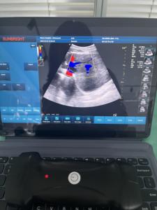 High Quality Vet Convex/<strong>Linear</strong>/Cardiac <strong>Ultrasound</strong> Machine Wireless 3 in 1 <strong>Ultrasound</strong> <strong>Probe</strong> JM-5 - Product Image 3