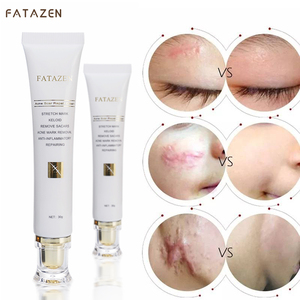2025 nuevo DuoYan Herbal Gel REPARADOR DE LA PIEL eficaz acné Natural marca de espinillas estrías crema para eliminar cicatrices - Product Image 5