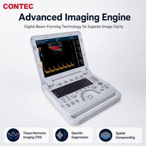 CONTEC CMS1700B Ecógrafo <span class=keywords><strong>Doppler</strong></span> Color para Ecocardiografía - Product Image 2