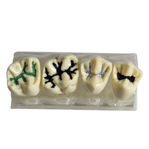 Modelo <span class=keywords><strong>de</strong></span> Sellador Dental <span class=keywords><strong>para</strong></span> <span class=keywords><strong>Fosas</strong></span> <span class=keywords><strong>y</strong></span> <span class=keywords><strong>Fisuras</strong></span> |   Modelo <span class=keywords><strong>de</strong></span> Dientes Removibles a Escala Real 4:1 <span class=keywords><strong>para</strong></span> Enseñanza Dental <span class=keywords><strong>y</strong></span> Práctica <span class=keywords><strong>de</strong></span> Exámenes - Product Image 3