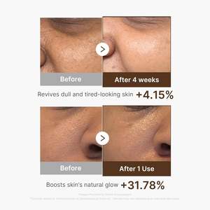 Sérum en capsules Medicube Deep Vita C 30 ml, sérum à la vitamine C pour le visage, hydratation et éclaircissement - Product Image 5