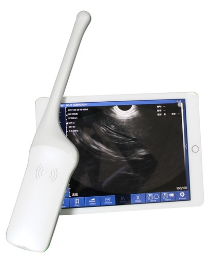 Wireless Transvaginal Ultrasound Handheld Wireless Ultrasound Scanner