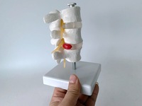 Modelo de Hernia Discal Lumbar Humana con Vértebras Desmontables para Quiroprácticos, Modelo de Columna Espinal de 3 Vértebras, CE/ISO