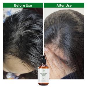 <span class=keywords><strong>Shampoing</strong></span> Marque Blanche Nettoyant en Profondeur Clarifiant Équilibrant Purifiant <span class=keywords><strong>Détoxifiant</strong></span> Volumisant Léger et Aérien pour Plus de Volume et le Contrôle du Sébum - Product Image 3