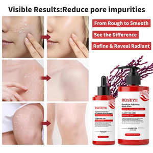 Siero Esfoliante <span class=keywords><strong>Viso</strong></span> all'Acido Ipocloroso, <span class=keywords><strong>Peeling</strong></span> Chimico Delicato, Trattamento Rivitalizzante Completo per il <span class=keywords><strong>Viso</strong></span> - Product Image 6