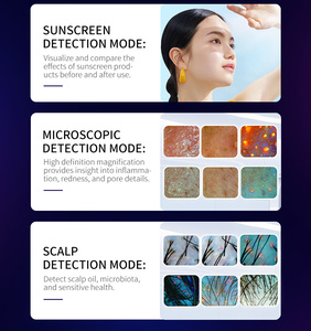 เครื่องวิเคราะห์ผิวหนังแบบสเปกตรัม AI สำหรับเดสก์ท็อป วิเคราะห์สิว ความชุ่มชื้น จุดด่างดำ พร้อมระบบจัดเก็บข้อมูลบนคลาวด์ - Product Image 5