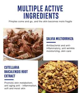 QBEKA Crema para el Tratamiento del Acné, Crema Facial para Marcas de Acné, Reduce los Poros, Hidrata la Piel - Product Image 3