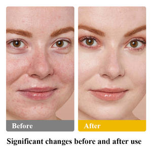 Rindfleisch Talg Balsam Hautpflege Balsam Gras Fed Rindfleisch Talg Körper Gesicht Feuchtigkeit creme Schlagsahne Balsam für Gesicht - Product Image 5