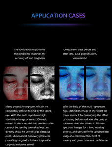 Portable 3D Large Screen Facial <b>Skin</b> Tester Equipment <b>SKin</b> <b>Analysis</b> Facial Care <b>Machine</b> - Product Image 6