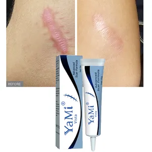 Marque privée Crème pour les vergetures d'acné Crème réparatrice pour l'élimination des cicatrices de brûlures de la peau du visage et des jambes