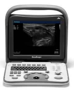 <span class=keywords><strong>Sonoscape</strong></span> <span class=keywords><strong>A5V</strong></span> B/W Portable Veterinary <span class=keywords><strong>Ultrasound</strong></span> Mesin - Product Image 4