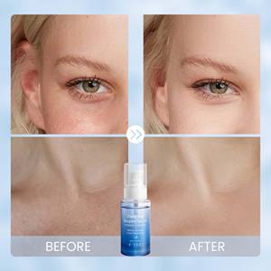 Vegan <span class=keywords><strong>Snow</strong></span> Mushroom <span class=keywords><strong>Dead</strong></span> Sea Facial Serum Liquid Anti-Wrinkle Whitening Skin Care Product - Product Image 2