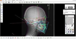 Conveniente Usato Carestream: Combinazione Panoramica CS 9000C 3D Panorex CEPH CONE BEAM per Imaging Panoramico e Cefalometrico - Product Image 4