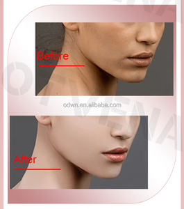 El favorito del cliente Blanqueamiento rápido Corrección de manchas <span class=keywords><strong>Mejor</strong></span> crema justa para la cara - Product Image 5