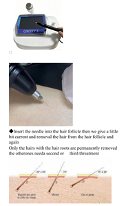 Épilation par électrolyse, soin de la peau, épilation permanente, appareil d'épilation par électrolyse avec aiguille pour le corps - Product Image 4