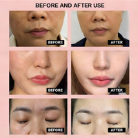 Masque facial intelligent à micro-courant alimenté par l'IA, infusé à l'acide kojique, anti-âge, liftant, raffermissant, tonifiant intelligent, masque noir
