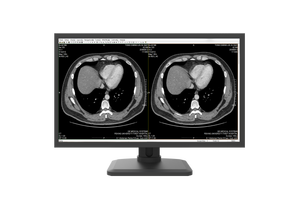 शीर्ष गुणवत्ता 4 एमपी रंग ग्रे चिकित्सा नैदानिक प्रदर्शन - Product Image 2