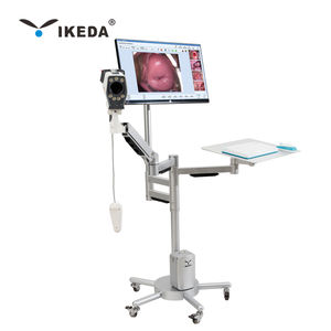 स्त्री रोग विज्ञान और गर्भाशय जांच के लिए fhd इमेजिंग के साथ YKD-3003 डिजिटल एचडी कोलोपोस्कोप - Product Image 4