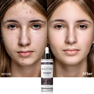Nhãn hiệu riêng vỏ bắn Glow gạo Ampoule tẩy tế bào chết màu đen và trắng gạo lột Glow Ampoule mềm tẩy tế bào chết huyết thanh - Product Image 6