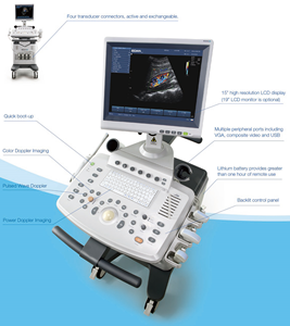 Troli USG <span class=keywords><strong>Edan</strong></span> U2 dengan 4 Konektor Transduser Sistem USG Doppler Warna Aktif - Product Image 6