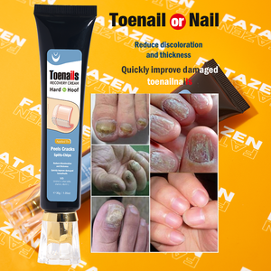 <span class=keywords><strong>Crema</strong></span> de reparación de <span class=keywords><strong>uñas</strong></span> hidratante profunda de etiqueta privada para <span class=keywords><strong>manos</strong></span> y pies OEM cuidado del cuerpo eficaz <span class=keywords><strong>crema</strong></span> de tratamiento de <span class=keywords><strong>hongos</strong></span> en las <span class=keywords><strong>uñas</strong></span> - Product Image 5