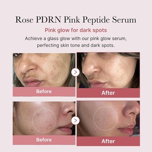 Sérum peptide rose PDRN personnalisé soins de la peau végétaliens de Corée hydratant raffermissant unifier le teint - Product Image 2