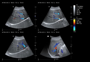 Ecógrafo Veterinario Zoncare Viv 60 con Precio Inmejorable, 3D y 4D, Doppler Color, con Carro, para Hospital Veterinario - Product Image 6