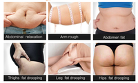 Crème amincissante anti-cellulite OEM/ODM personnalisable pour votre propre marque