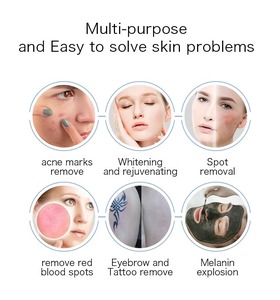 Portable 3 Tips Tattoo Remover Black MOle Removal Pico Second Carbon Peel Tattoo Removal Machine - Product Image 5