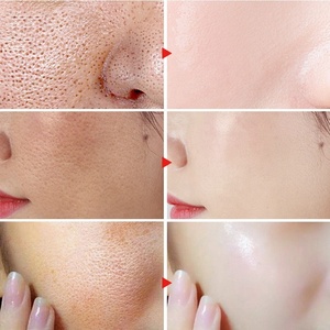 2% acide salicylique, élimine les taches d'acné, 5% acide lactique, rétrécissement des pores, <span class=keywords><strong>s</strong></span>érum pour le visage, Anti-âge, acide kojique - Product Image 3