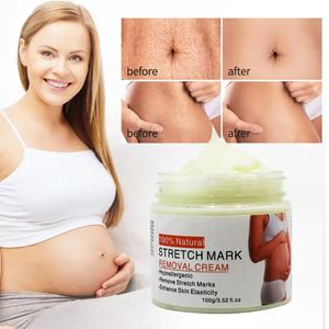 Vente en gros de crème pour le soin du corps 100g, améliore l'élasticité de la peau, crème pour éliminer les vergetures - Product Image 5