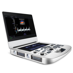 Échographe Doppler portable de type ordinateur portable, imagerie couleur avec mesures automatiques, 256 images, boucle cinématographique pour diagnostic général - Product Image 2
