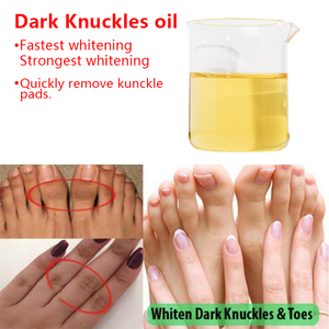 Huile Éclaircissante pour les Taches Sombres des Articulations, Crème Blanchissante la Plus Efficace, Crème Corporelle Forte pour Éliminer les Taches Noires, Ingrédients Pré-Mélangés - Product Image 2