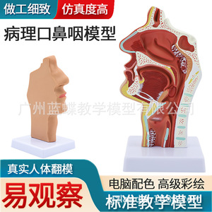 Secciones patológicas de la cavidad nasal, faringe, orofaringe, laringo-faringe, cavidad nasal y cavidad oral; modelo anatómico - Product Image 3