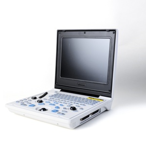 Máquina <span class=keywords><strong>de</strong></span> <span class=keywords><strong>Ultrasonido</strong></span> Médica Portátil <span class=keywords><strong>de</strong></span> Bajo <span class=keywords><strong>Precio</strong></span>, Imágenes en Blanco y Negro, Sonda Dual Convexa Lineal, Uso Veterinario y Humano - Product Image 1
