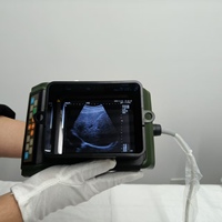 Système d'échographie vétérinaire numérique, sonde d'échographie vétérinaire portable, appareil d'échographie cardiaque animale