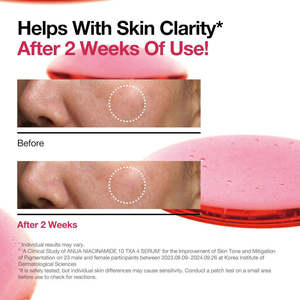 OME Tampons exfoliants doux et éclaircissants 5% Niacinamide TXA Tonique Acide Hyaluronique Hydratant Illuminateur - Product Image 5