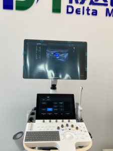 Système d'échographie Doppler couleur Sonoscape P60 sur chariot, élastographie haute définition multi-usages pour la médecine vétérinaire - Product Image 1