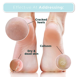 Masque pour les pieds exfoliant à la rose avec <span class=keywords><strong>prix</strong></span> d'usine en gros - Product Image 5
