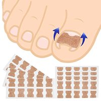 Patch Correcteur d'Ongles Incarnés Sans Colle, Anti-Adhésif, à Application Facile, Anti-Traction, Modèle Correcteur