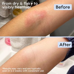 <span class=keywords><strong>Crema</strong></span> Lenitiva al Miele di Manuka - <span class=keywords><strong>Crema</strong></span> Idratante Profonda per Eczema con Avena Colloidale - Sollievo Istantaneo al Miele di Manuka per Pelle Secca e Pruriginosa - Product Image 6