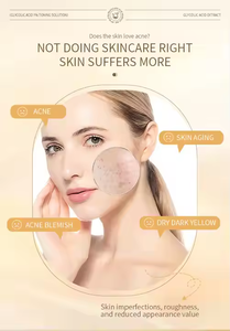 Bestseller VEZE Balsamo Labbra all'Acido Ialuronico Organico con Caffeina e Vitamina E, Lozione Idratante - Cura Labbra Delicata a Prezzo di Fabbrica - Product Image 3