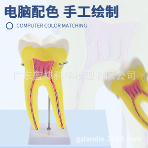 Modèle anatomique de molaire humaine, grande dent pour l'enseignement en maternelle et la formation médicale, avec base et support. - Product Image 1