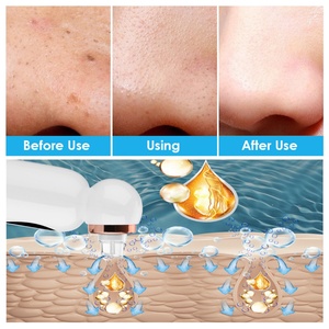 Petit aspirateur à bulles pour le soin de la peau à domicile, nettoyeur de pores pour le visage, forte puissance d'aspiration, appareil pour éliminer les points noirs - Product Image 5